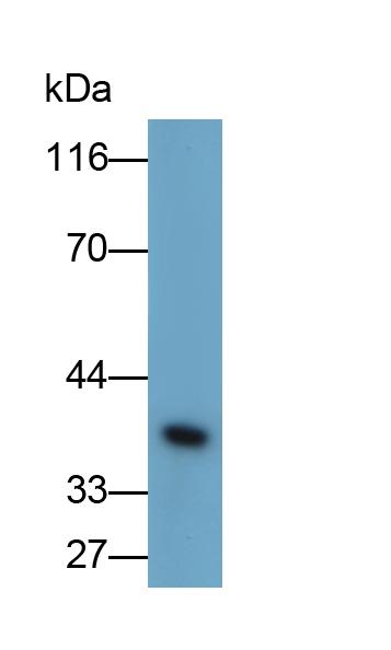 Monoclonal Antibody to Receptor Activator Of Nuclear Factor Kappa B Ligand (RANkL)