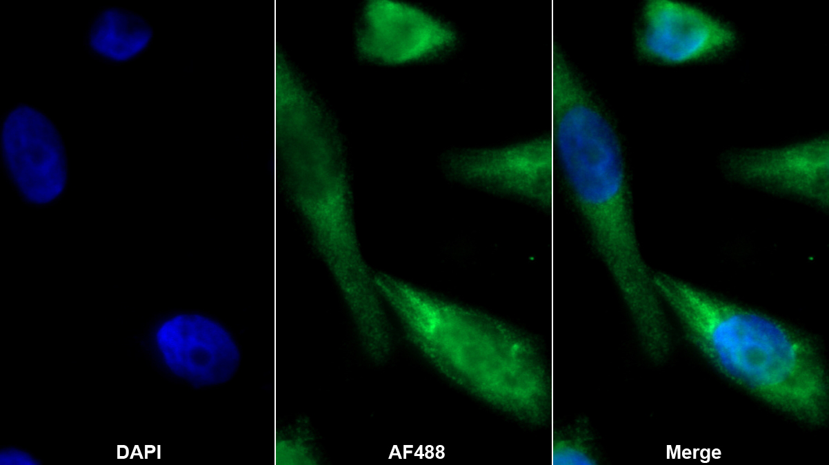 Monoclonal Antibody to Receptor Activator Of Nuclear Factor Kappa B Ligand (RANkL)