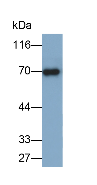 Monoclonal Antibody to Mannose Associated Serine Protease 2 (MASP2)