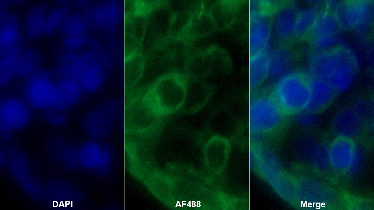 Monoclonal Antibody to Renin (REN)