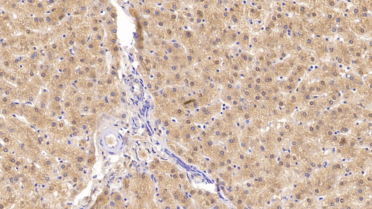 Monoclonal Antibody to Insulin Receptor (INSR)