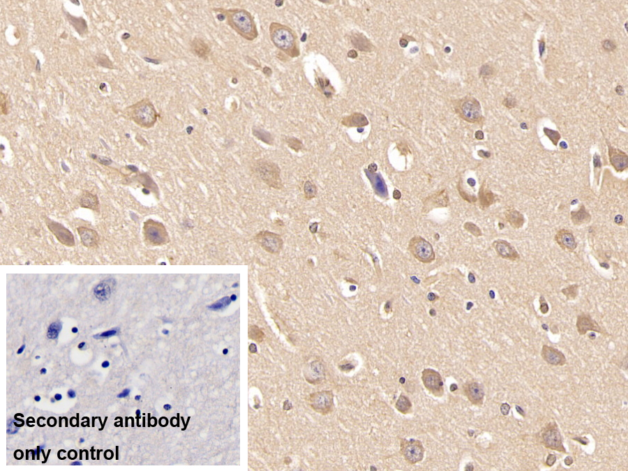 Monoclonal Antibody to Insulin Receptor (INSR)