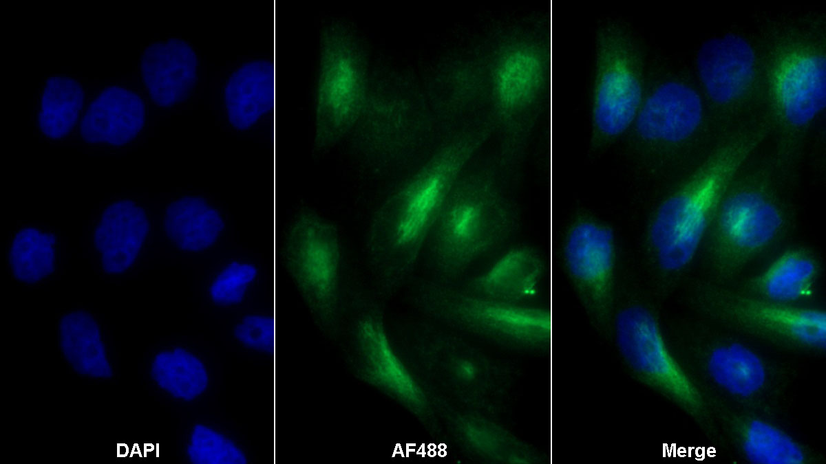 Monoclonal Antibody to Insulin Receptor (INSR)