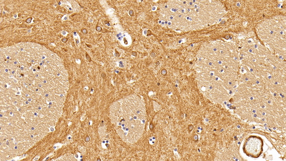 Monoclonal Antibody to Insulin Receptor (INSR)