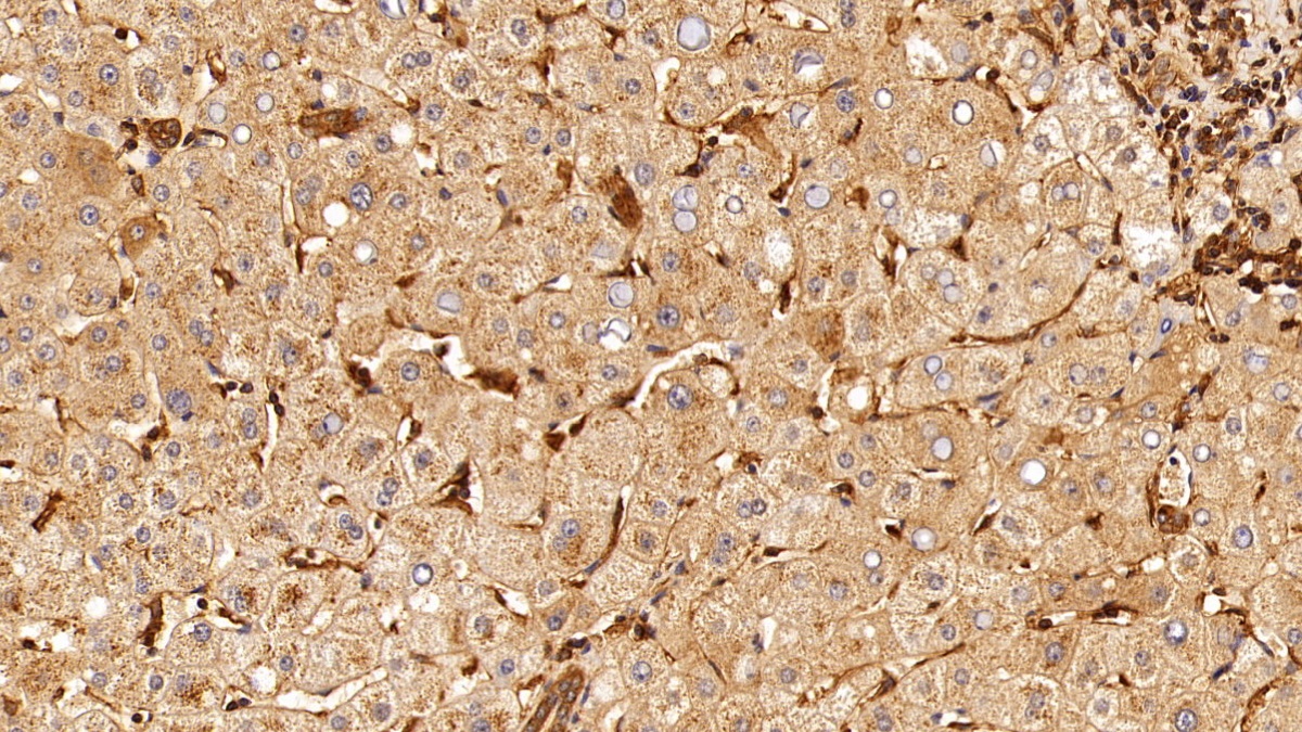 Monoclonal Antibody to Insulin Receptor (INSR)