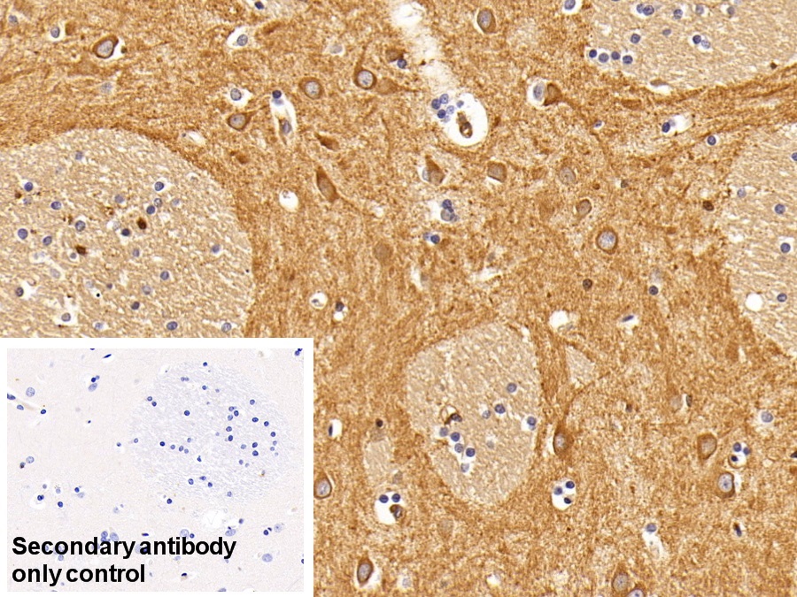 Monoclonal Antibody to Insulin Receptor (INSR)