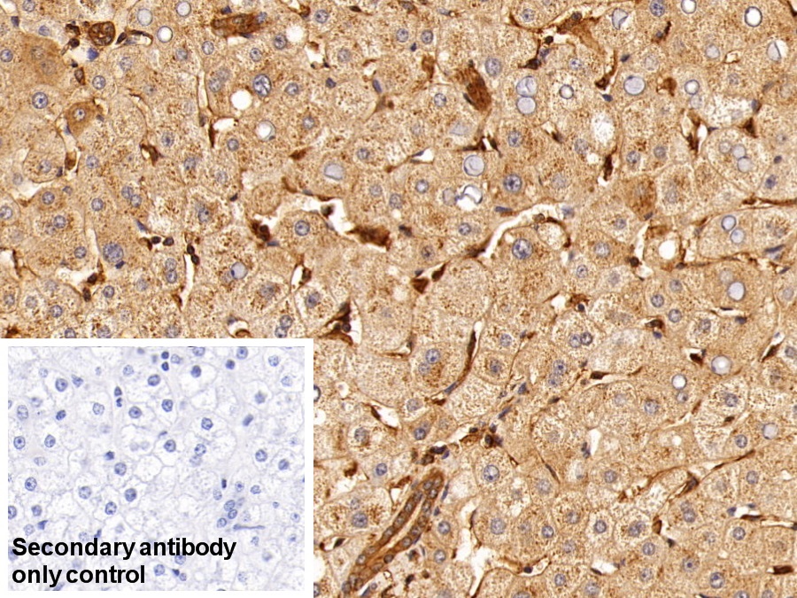 Monoclonal Antibody to Insulin Receptor (INSR)
