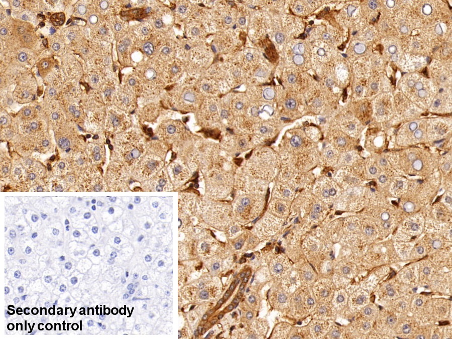 Monoclonal Antibody to Insulin Receptor (INSR)