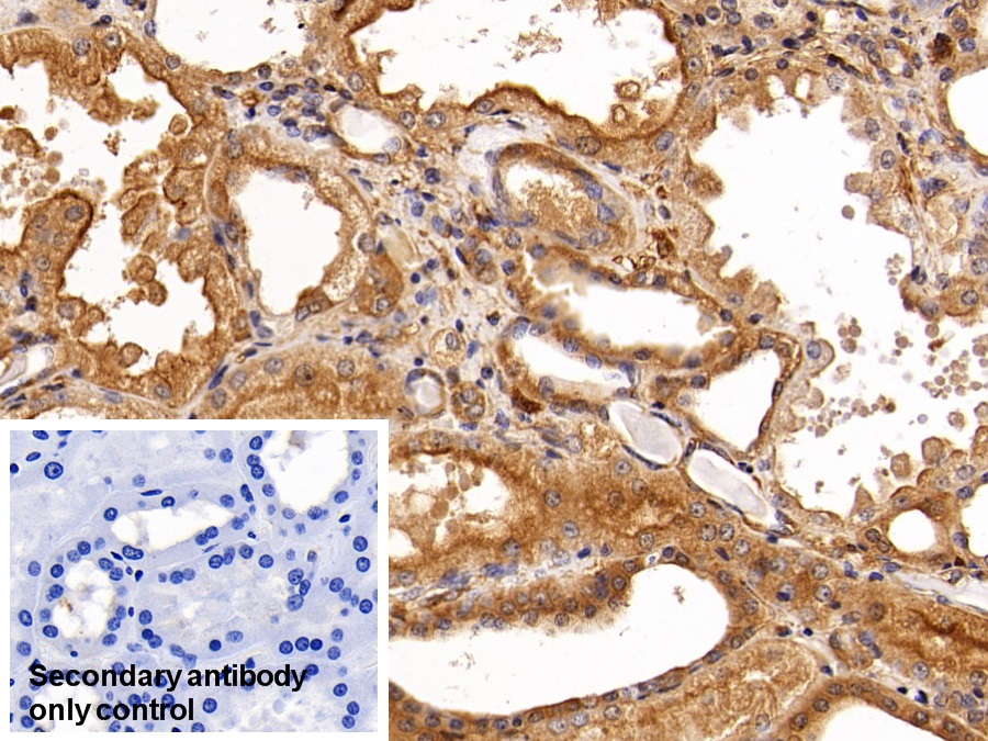 Monoclonal Antibody to Insulin Receptor (INSR)