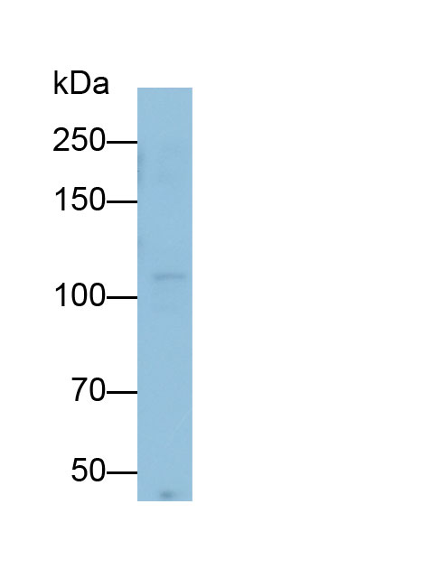 Monoclonal Antibody to Insulin Receptor (INSR)