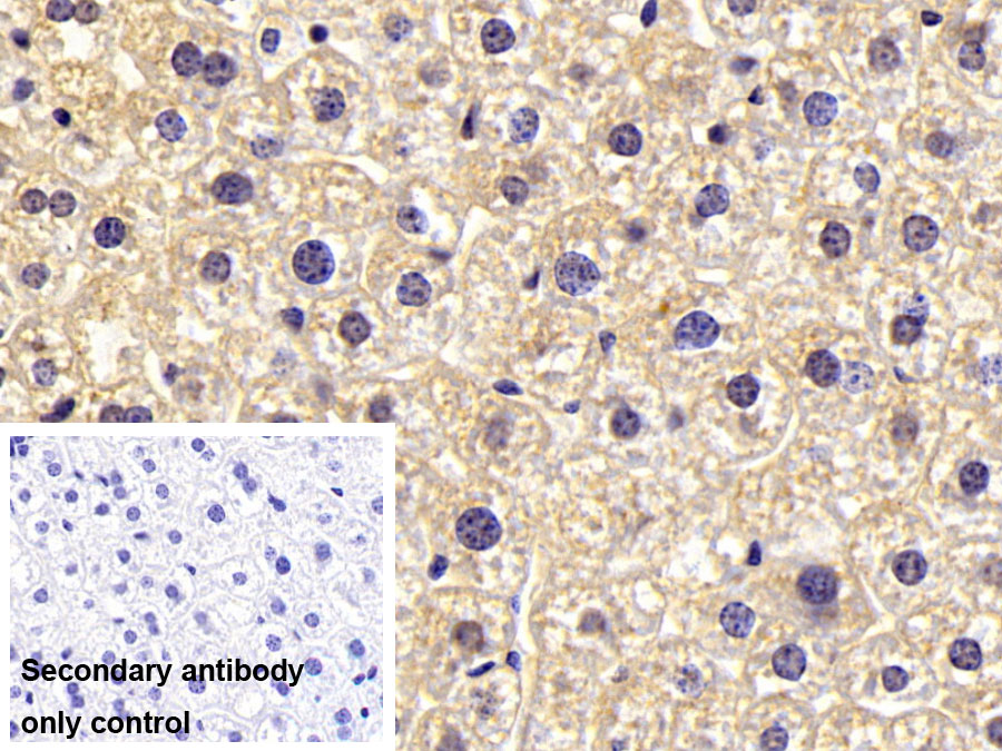 Monoclonal Antibody to Insulin Receptor (INSR)