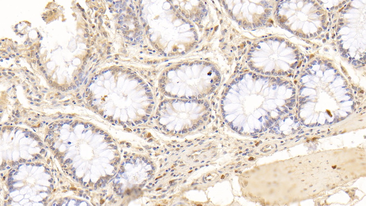 Monoclonal Antibody to Osteopontin (OPN)