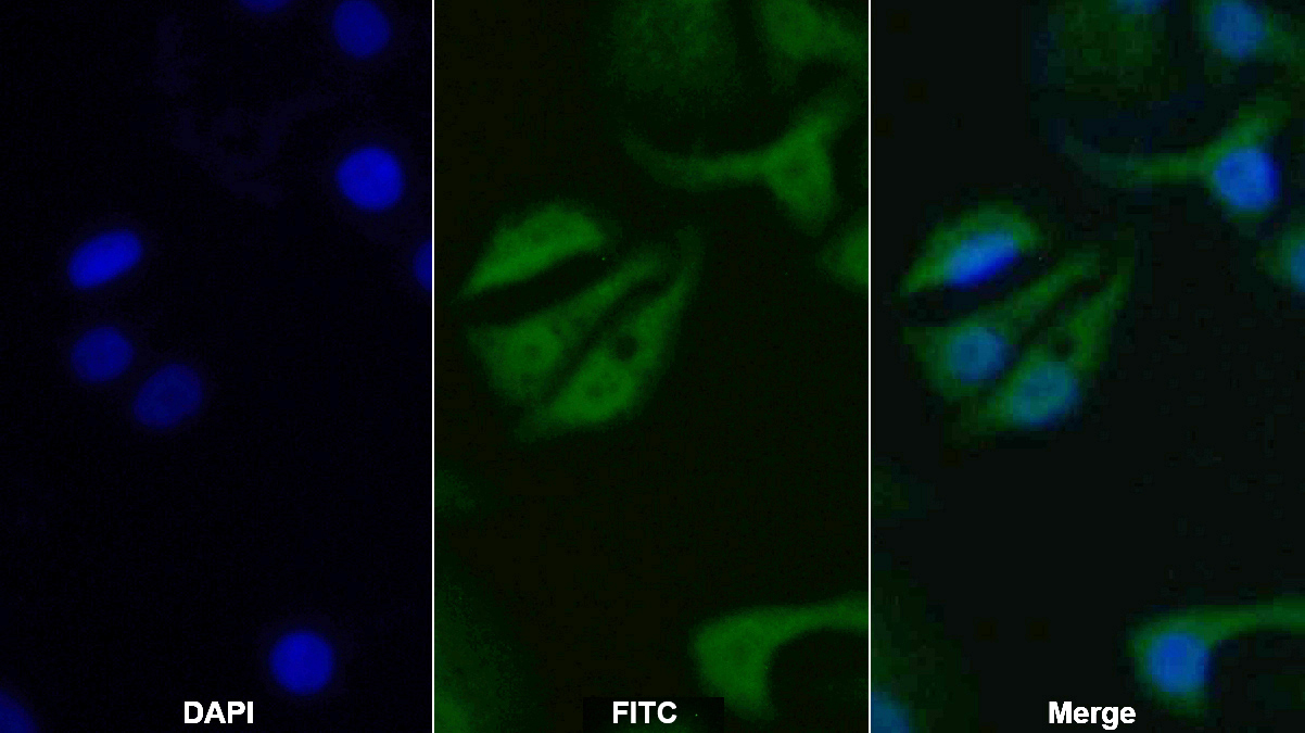 Monoclonal Antibody to Tumor Protein p53 (P53)