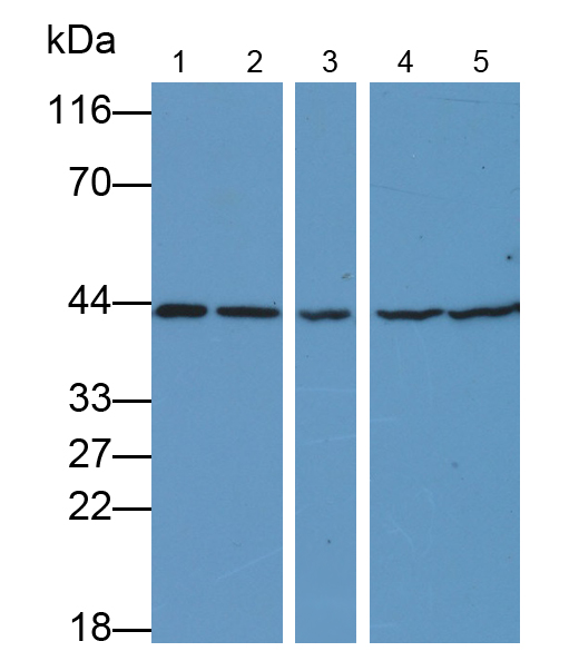 Monoclonal Antibody to Tumor Protein p53 (P53)