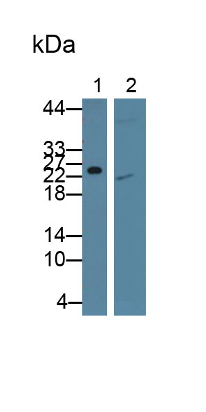 Monoclonal Antibody to Retinol Binding Protein 4 (RBP4)