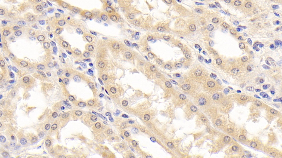 Monoclonal Antibody to Retinol Binding Protein 4 (RBP4)