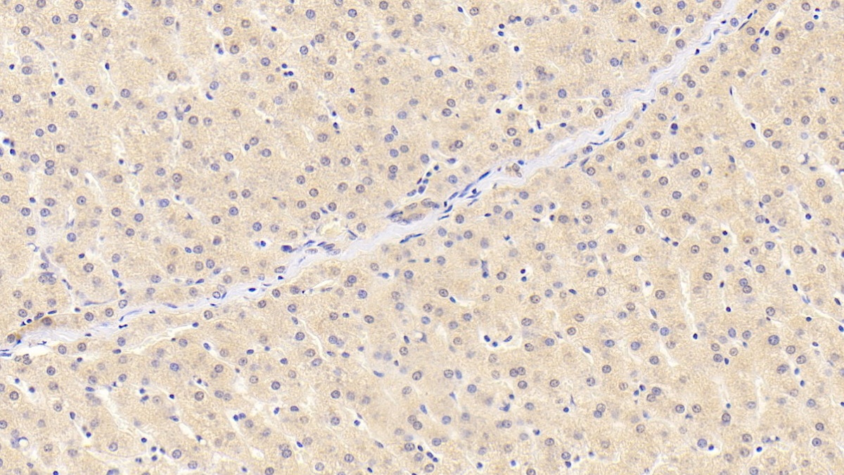 Monoclonal Antibody to Retinol Binding Protein 4 (RBP4)