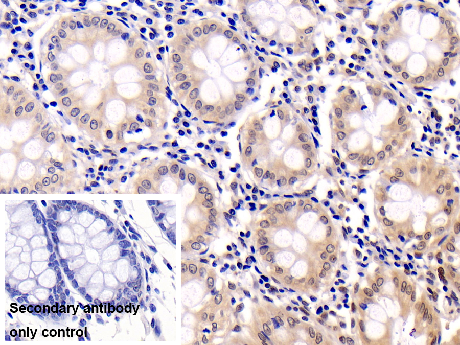 Monoclonal Antibody to Extracellular Signal Regulated Kinase 2 (ERK2)