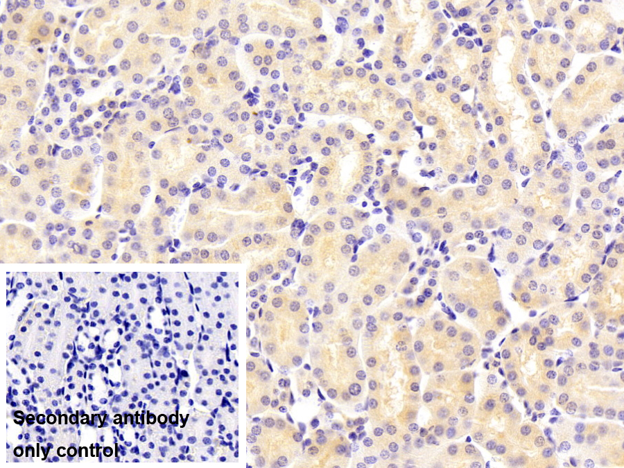 Monoclonal Antibody to Phosphoenolpyruvate Carboxykinase 1, Soluble (PCK1)