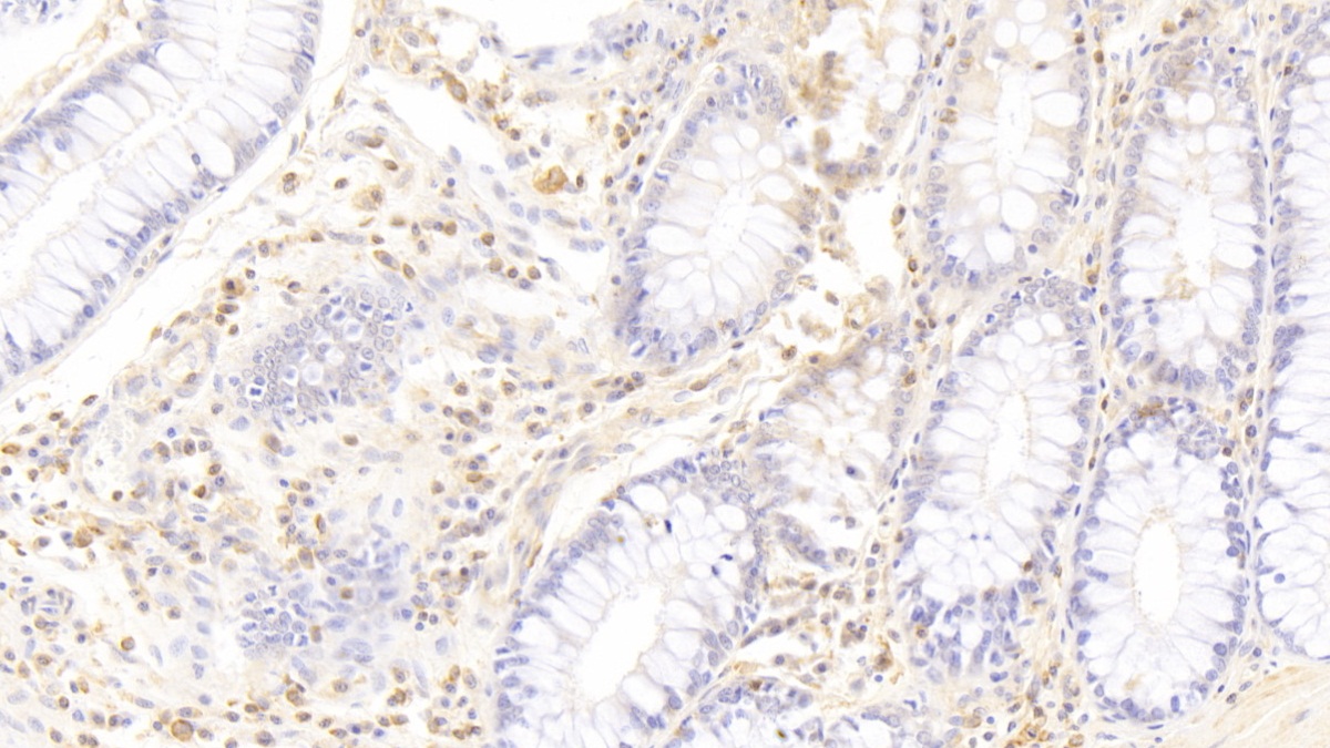 Monoclonal Antibody to Neutrophil Specific Antigen 1 (NB1)