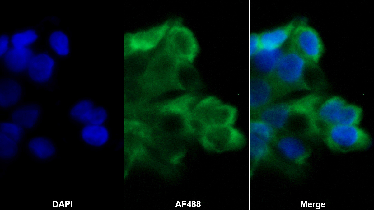 Monoclonal Antibody to Chemerin (CHEM)