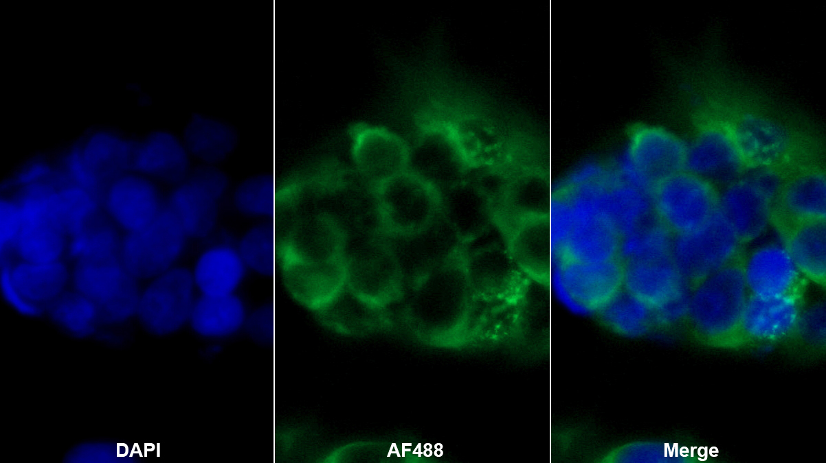 Monoclonal Antibody to Chemerin (CHEM)