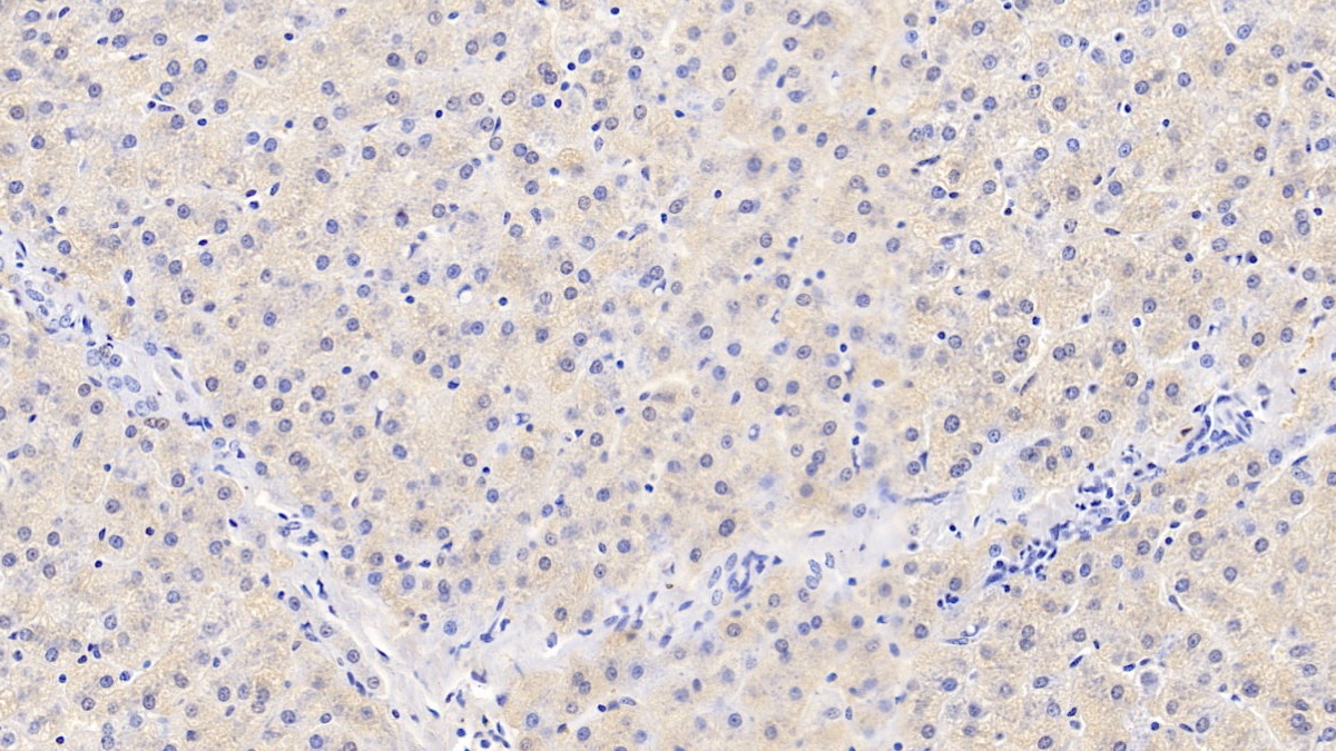 Monoclonal Antibody to Chemerin (CHEM)