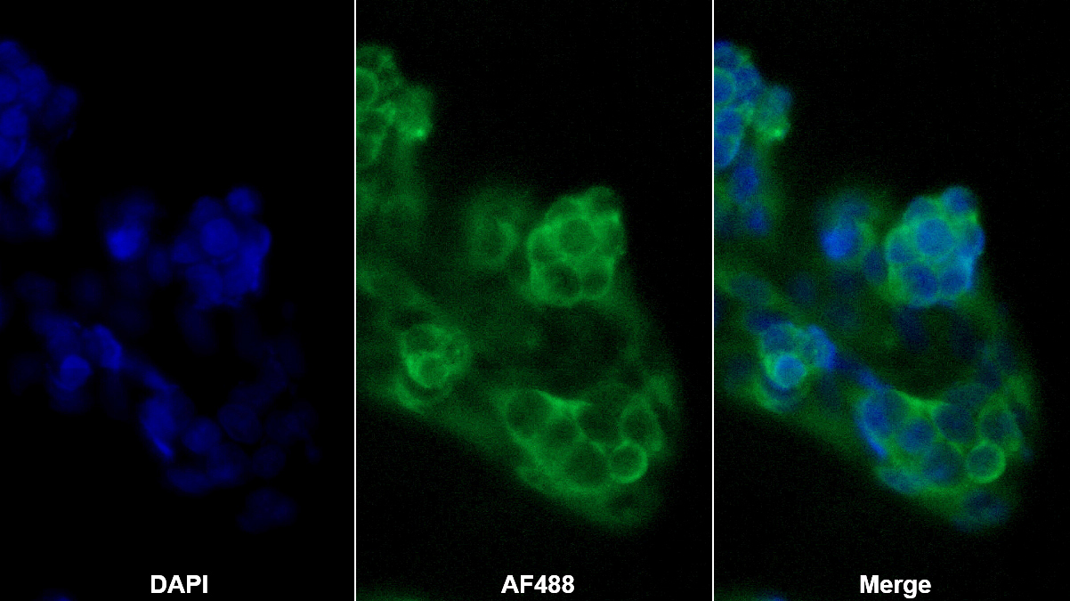 Monoclonal Antibody to Chemerin (CHEM)