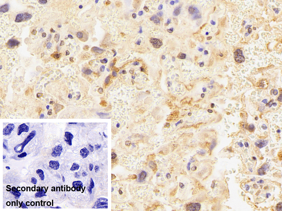 Monoclonal Antibody to Cyclophilin A (CYPA)