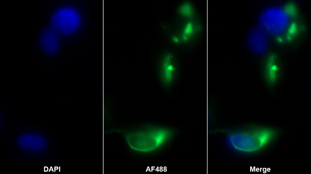 Monoclonal Antibody to Protein Zero, Myelin (MPZ)