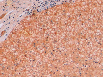 Monoclonal Antibody to Beta Catenin (β-catenin)
