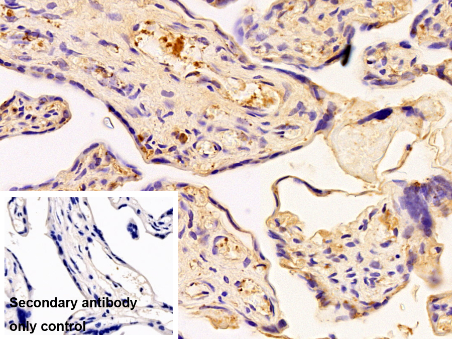 Monoclonal Antibody to Albumin (ALB)