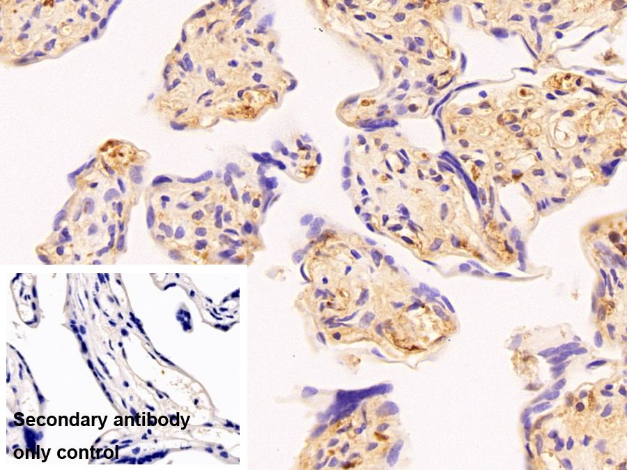 Monoclonal Antibody to Albumin (ALB)