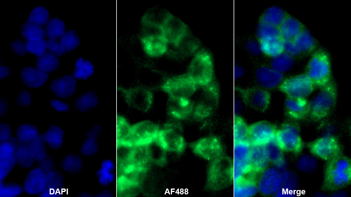 Monoclonal Antibody to Albumin (ALB)