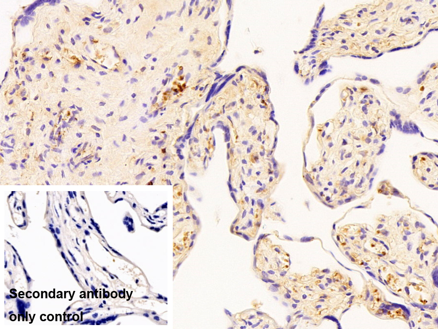 Monoclonal Antibody to Albumin (ALB)