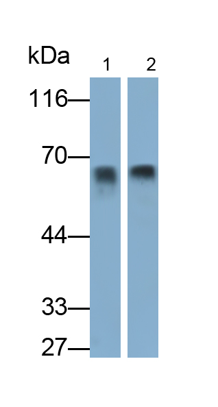 Monoclonal Antibody to Albumin (ALB)