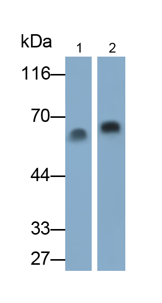 Monoclonal Antibody to Albumin (ALB)