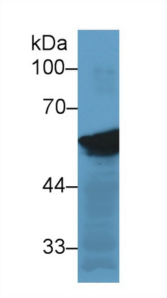 Monoclonal Antibody to Vimentin (VIM)