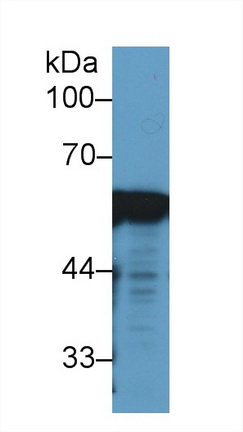 Monoclonal Antibody to Vimentin (VIM)