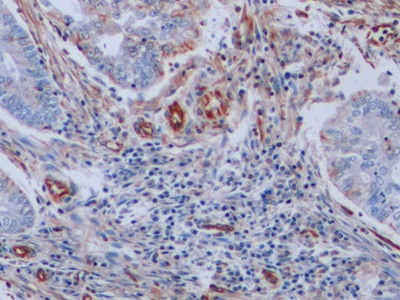 Monoclonal Antibody to Vimentin (VIM)