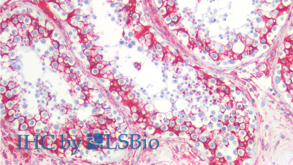 Monoclonal Antibody to Vimentin (VIM)