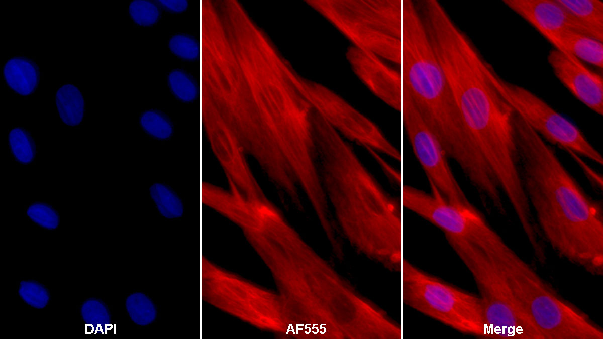 Monoclonal Antibody to Vimentin (VIM)