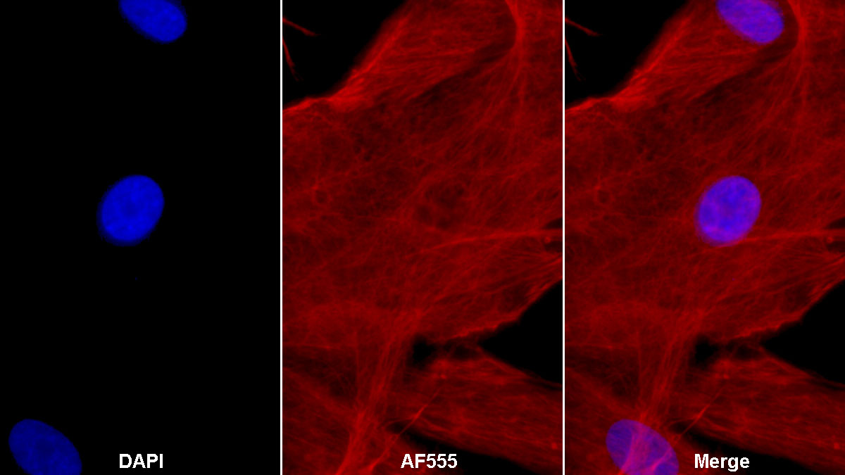 Monoclonal Antibody to Vimentin (VIM)