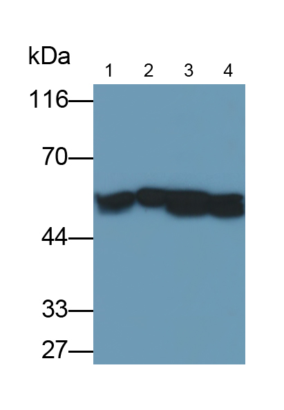 Monoclonal Antibody to Vimentin (VIM)