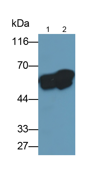 Monoclonal Antibody to Vimentin (VIM)