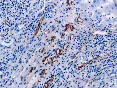 Monoclonal Antibody to Vimentin (VIM)