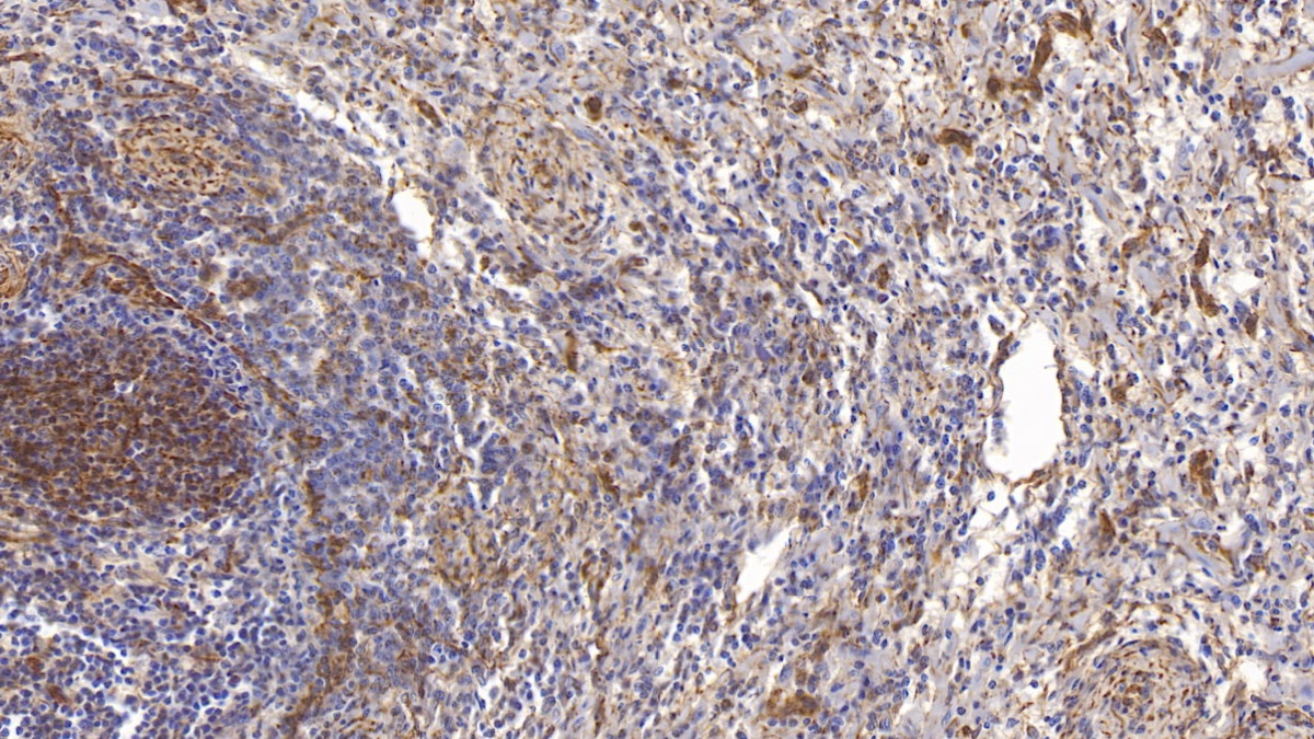 Monoclonal Antibody to Vimentin (VIM)