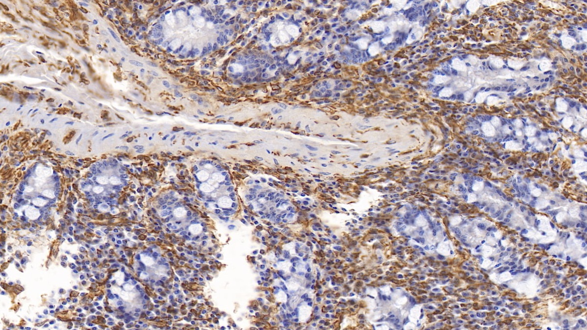 Monoclonal Antibody to Vimentin (VIM)