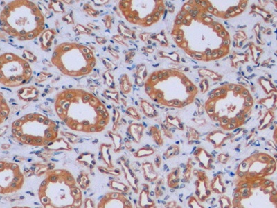 Monoclonal Antibody to Vimentin (VIM)