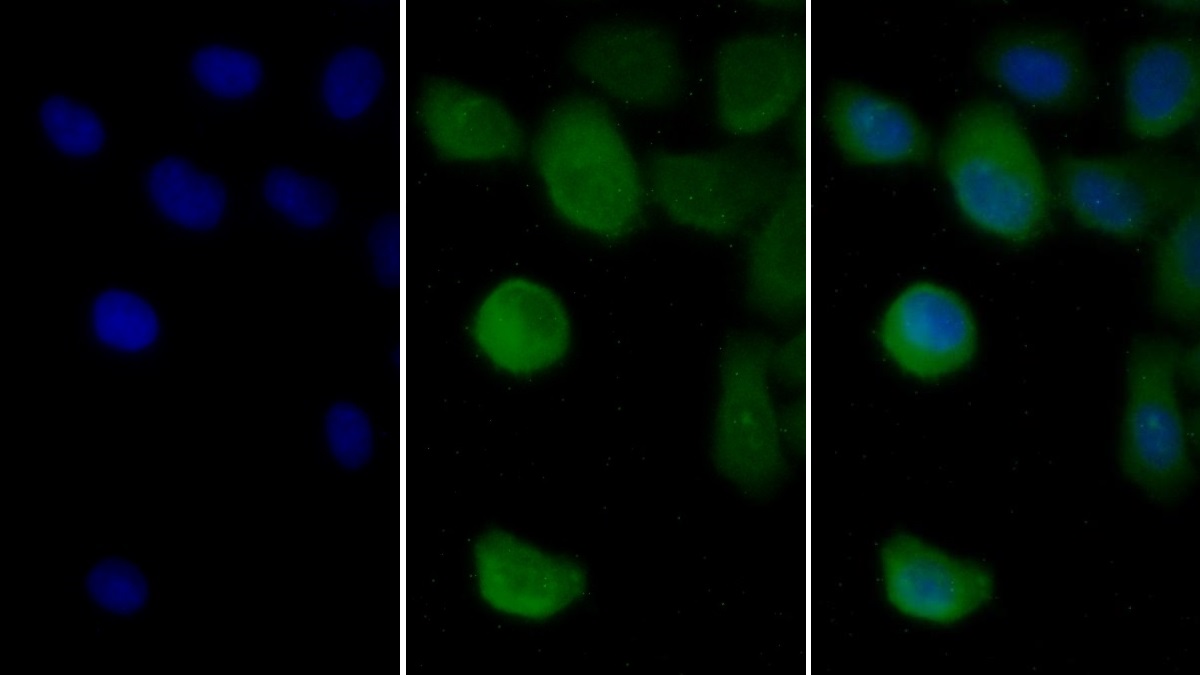 Monoclonal Antibody to Vimentin (VIM)